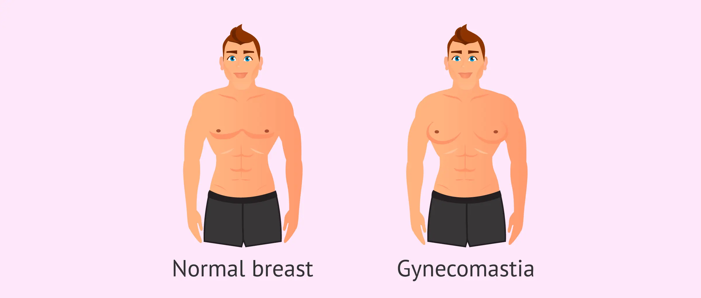 Gynecomastia Vs Normal Breast 1