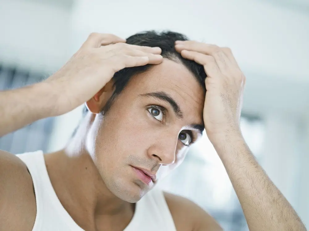 Hairloss 1 1