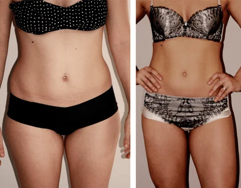Clenbuterol For Women - Women Body Before And After Usage Comparison