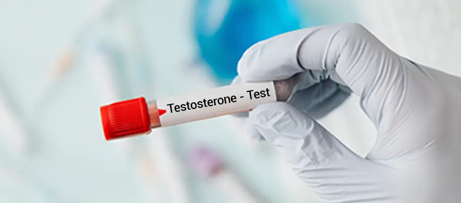 Testosterone Testing